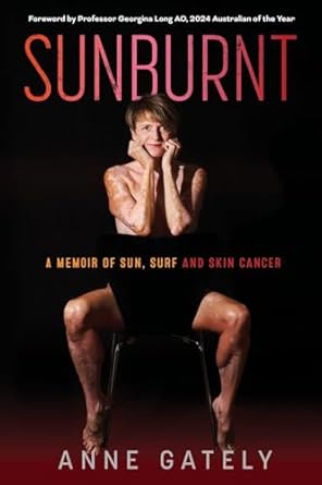 Sunburnt: A memoir of sun, surf and skin cancer