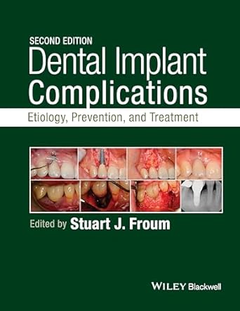 Dental Implant Complications: Etiology, Prevention, and Treatment