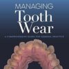 Managing Tooth Wear. A Comprehensive Guide For General Practice