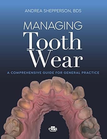 Managing Tooth Wear. A Comprehensive Guide For General Practice