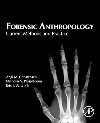 Forensic Anthropology: Current Methods and Practice