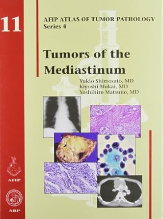 Tumors of the Mediastinum: No. 11