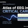 Hirsch and Brenner's Atlas of EEG in Critical Care