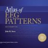 Atlas of EEG Patterns