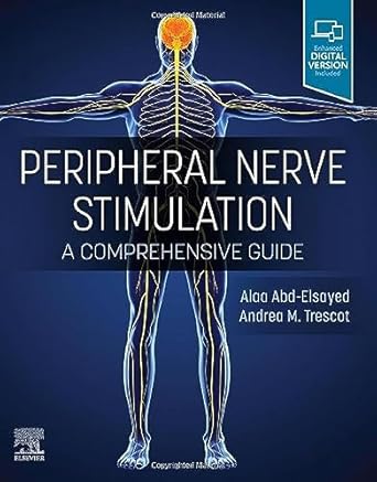 Peripheral Nerve Stimulation: A Comprehensive Guide