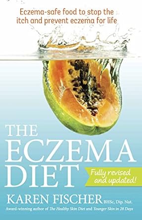 The Eczema Diet: Eczema-safe Food to Stop the Itch and Prevent Eczema for Life