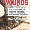 Gunshot Wounds: Practical Aspects of Firearms, Ballistics, and Forensic Techniques, Third Edition: 62