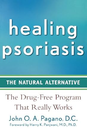 Healing Psoriasis: The Natural Alternative