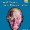 Local Flaps in Facial Reconstruction
