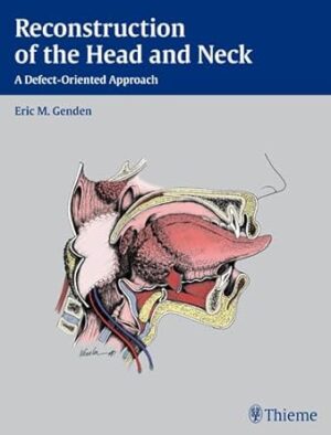 Reconstruction of the Head and Neck: A Defect-Oriented Approach