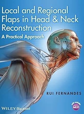Local and Regional Flaps in Head and Neck Reconstruction: A Practical Approach